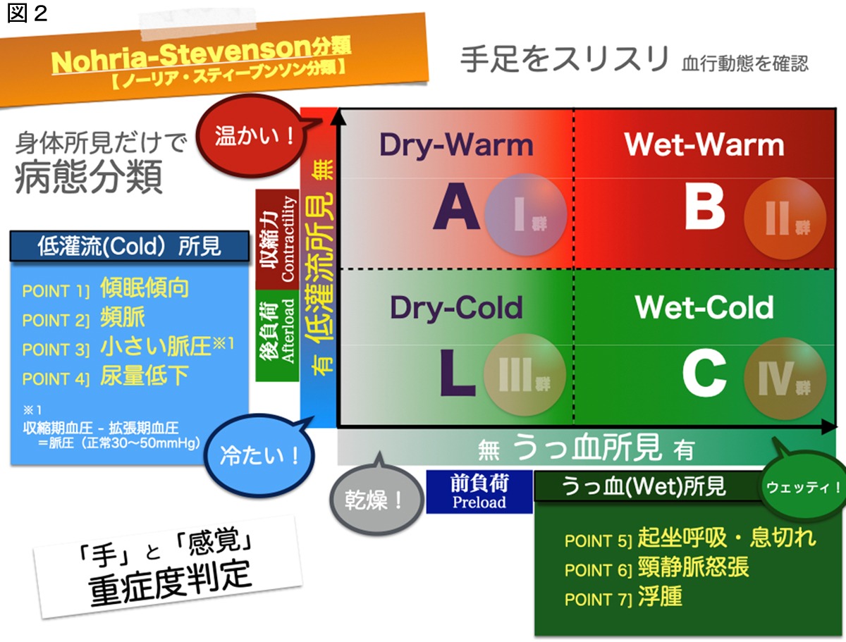 スワンガンツカテーテル挿入手順