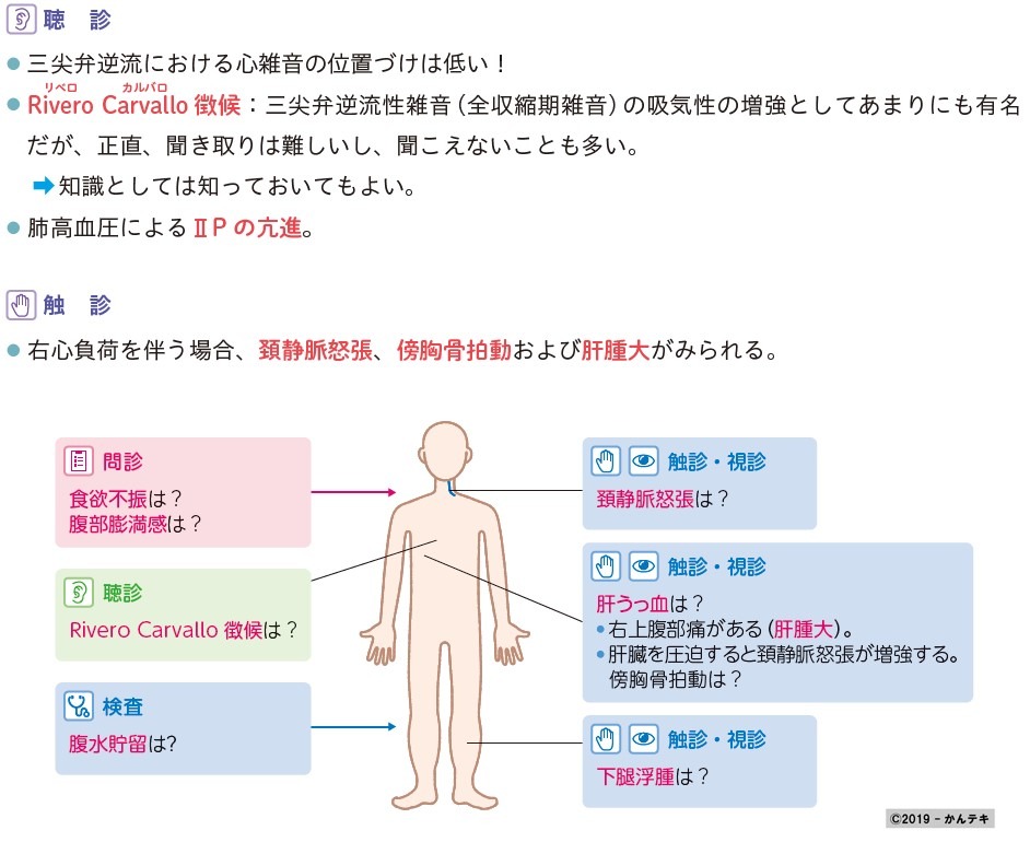 三尖弁逆流の治療選択肢