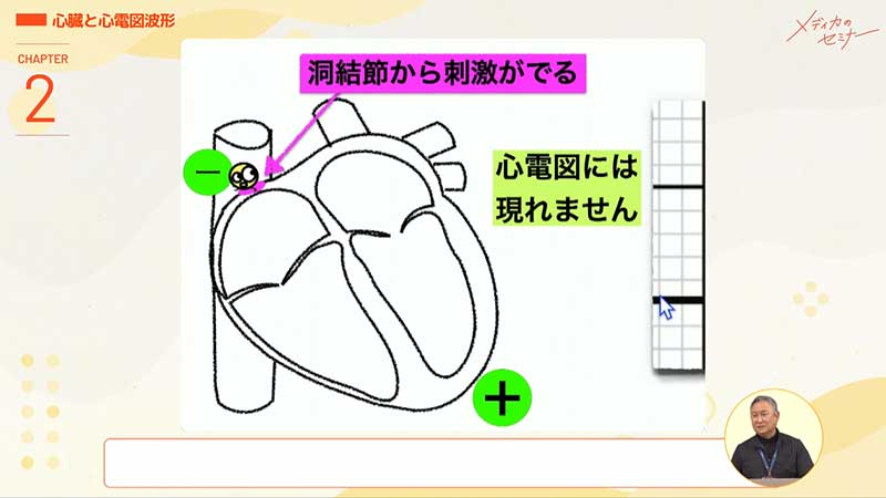 心電図16波形03