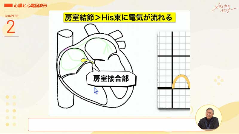 心電図16波形10