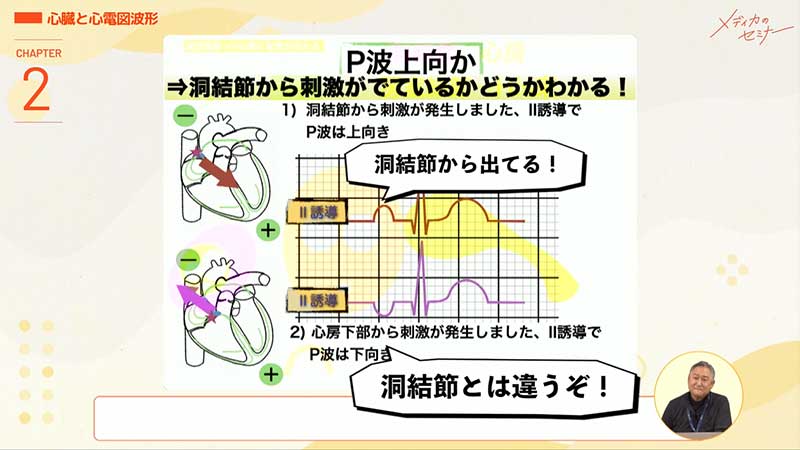 心電図16波形07