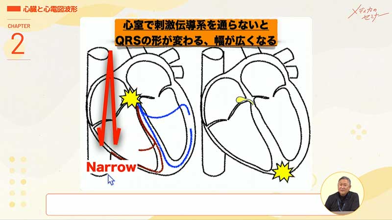 心電図16波形14