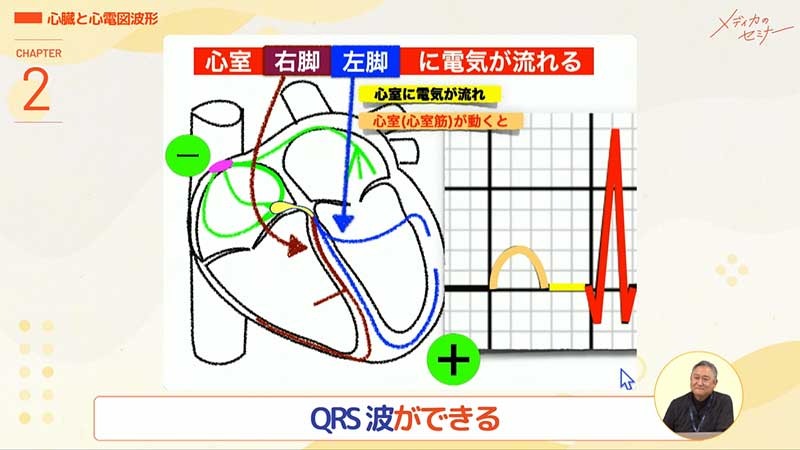 心電図16波形13