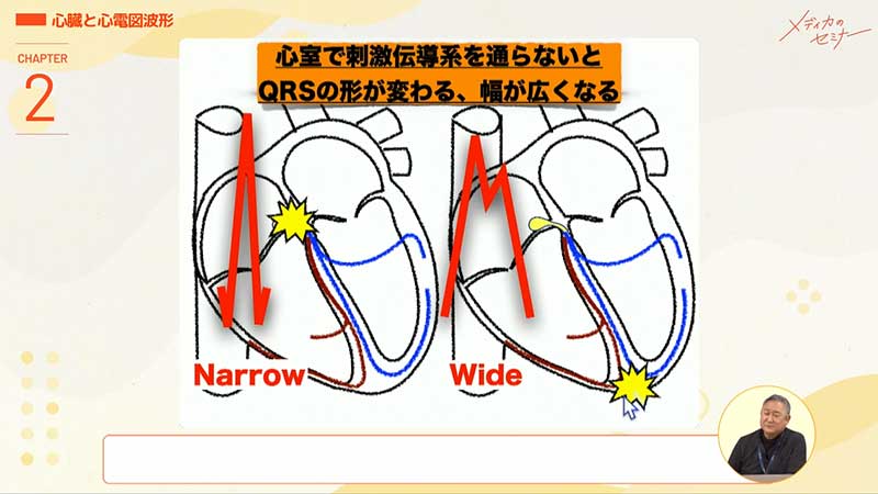 心電図16波形15