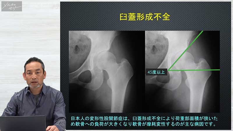 整形外科手術と術後ケア04