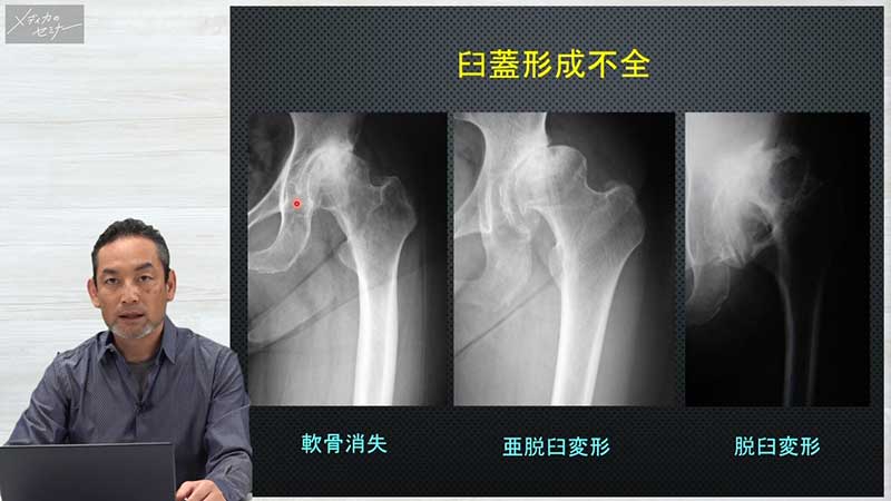 整形外科手術と術後ケア05