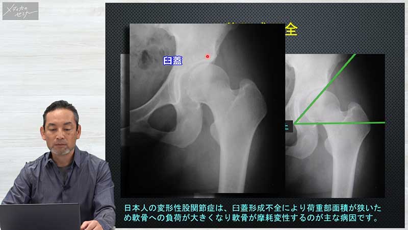 整形外科手術と術後ケア03