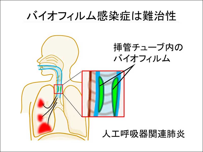 染方史郎の3分細菌楽_005_14