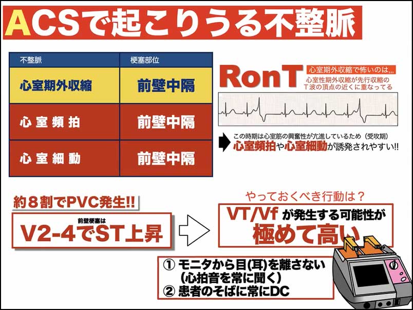 心カテ前～中～後のこれだけ知識02_05