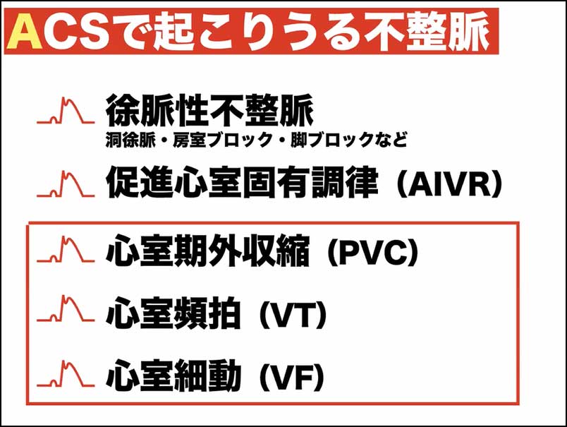 心カテ前～中～後のこれだけ知識02_02