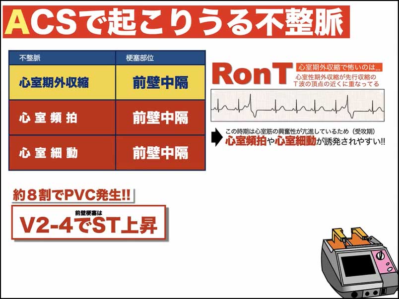 心カテ前～中～後のこれだけ知識02_04