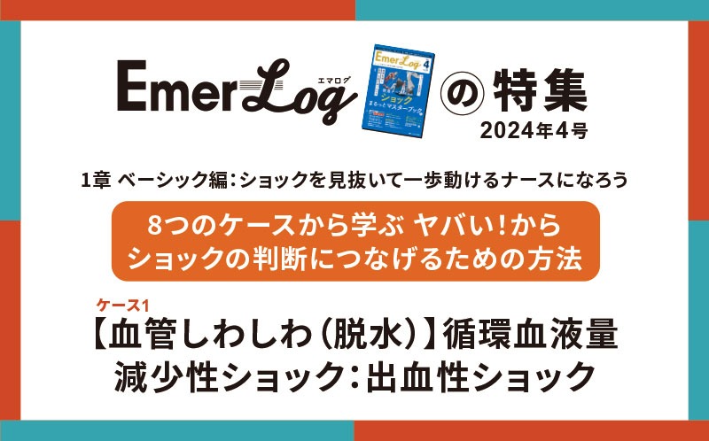 【血管しわしわ（脱水）】循環血液量減少性ショック：出血性ショック｜Emer-Logの特集｜2024年4号