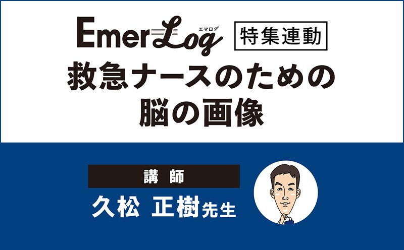 初療でパッとみて、読影のコツ＆看護ポイントがわかる！救急ナースのための脳の画像｜メディカのセミナー｜久松正樹