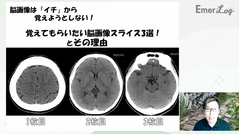 救急ナースのための脳の画像04