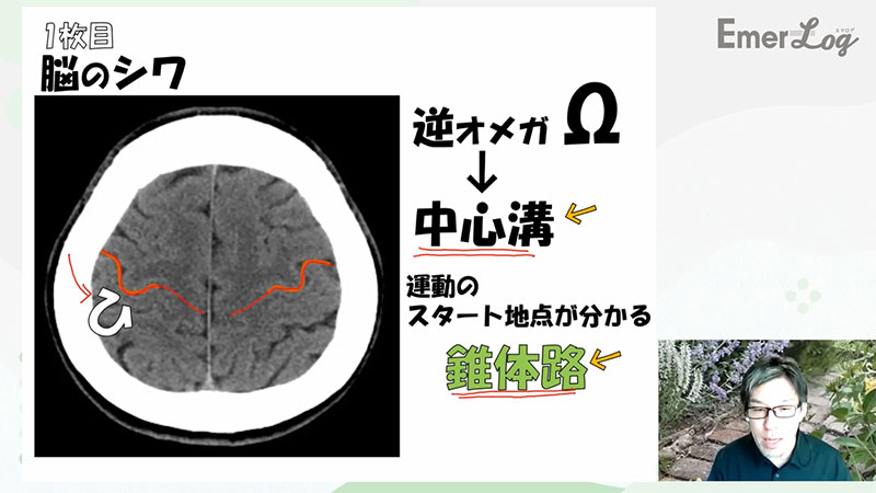 救急ナースのための脳の画像09