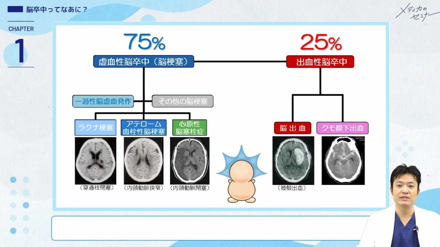 ぎゅぎゅっと濃縮 脳卒中の病態・症状・治療とケア06