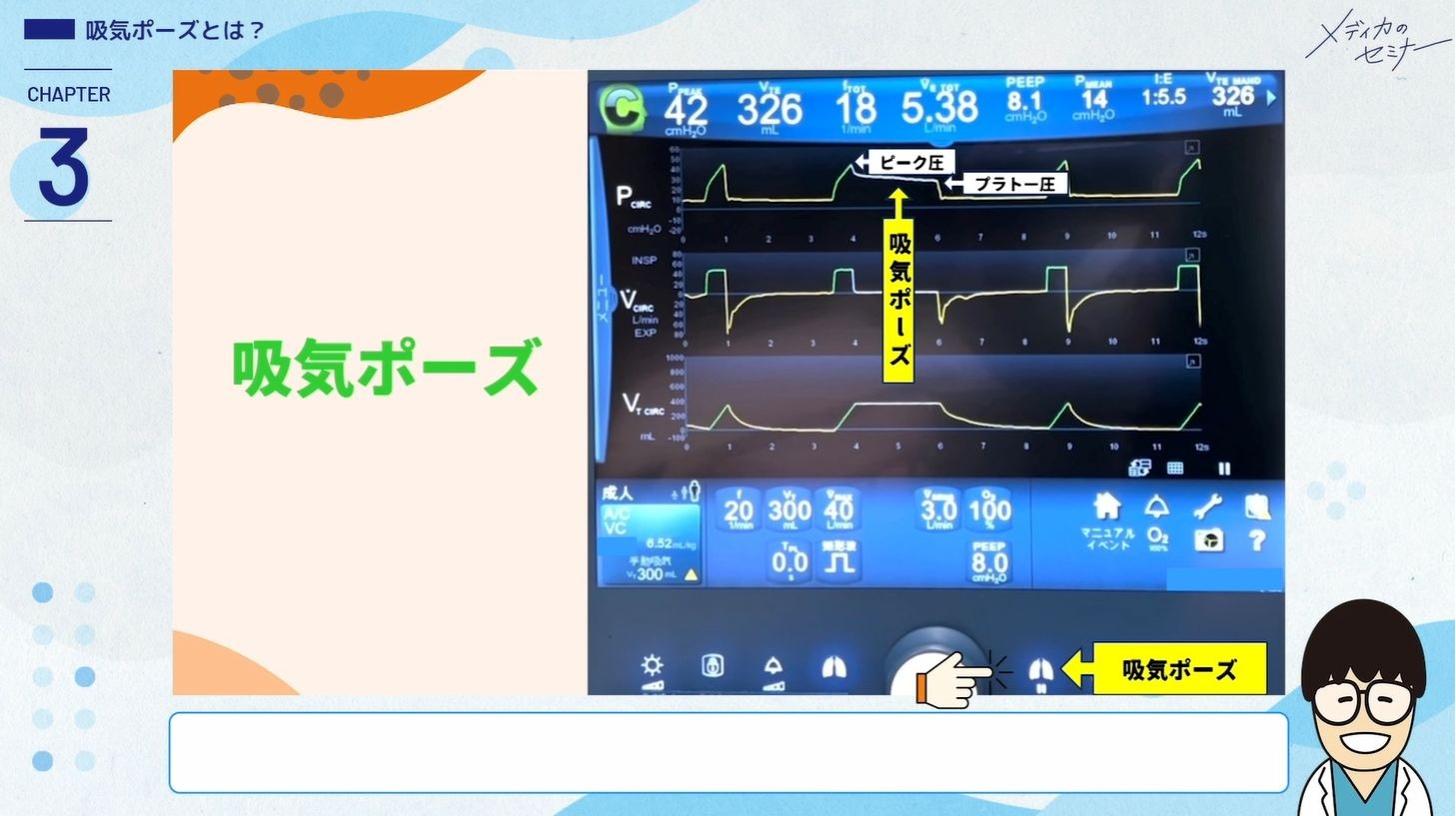 現場発！ 人工呼吸器 グラフィックの基本・非同調・アラーム対応04