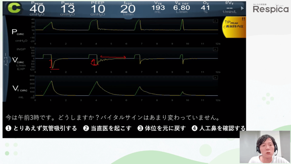 ゼッタイ見逃したくない人工呼吸管理中の異常09