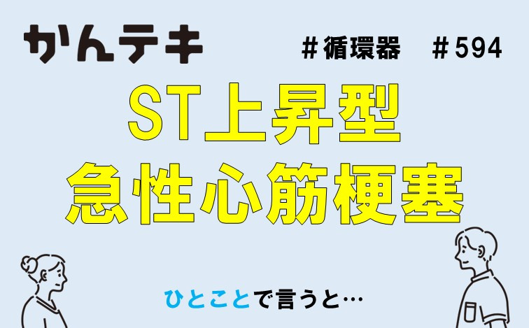 ひとことで言うと… #594｜ST上昇型急性心筋梗塞