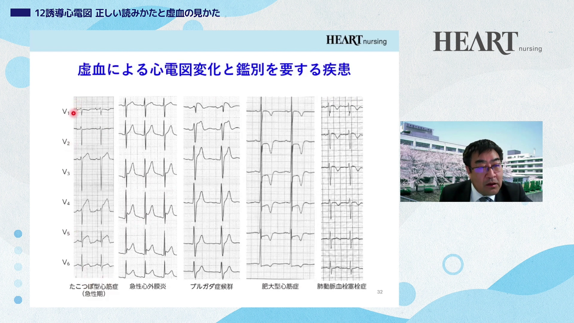 12誘導心電図 正しい読みかたと虚血の見かた01
