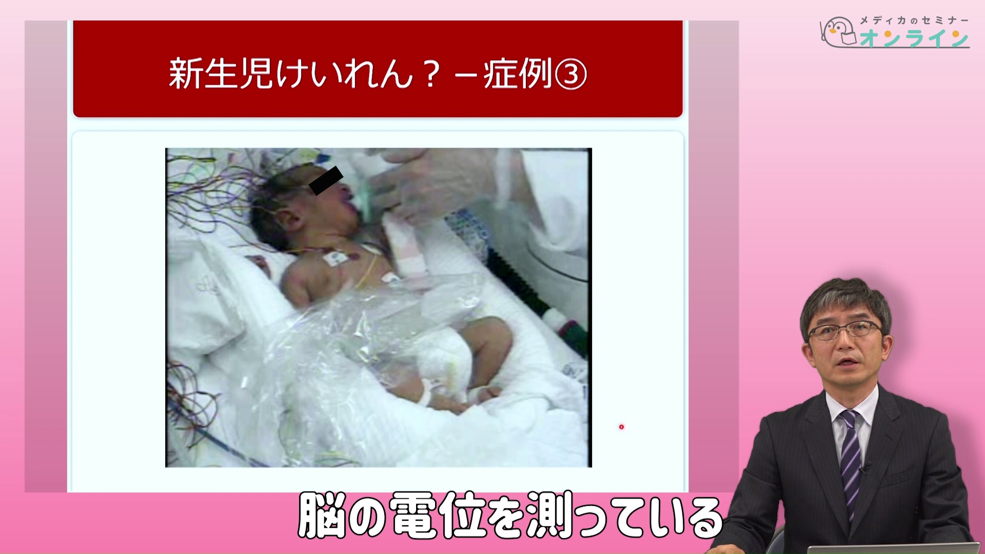 助産師・看護師が知っておきたい正期産児の観察ポイント_症状・疾患編09
