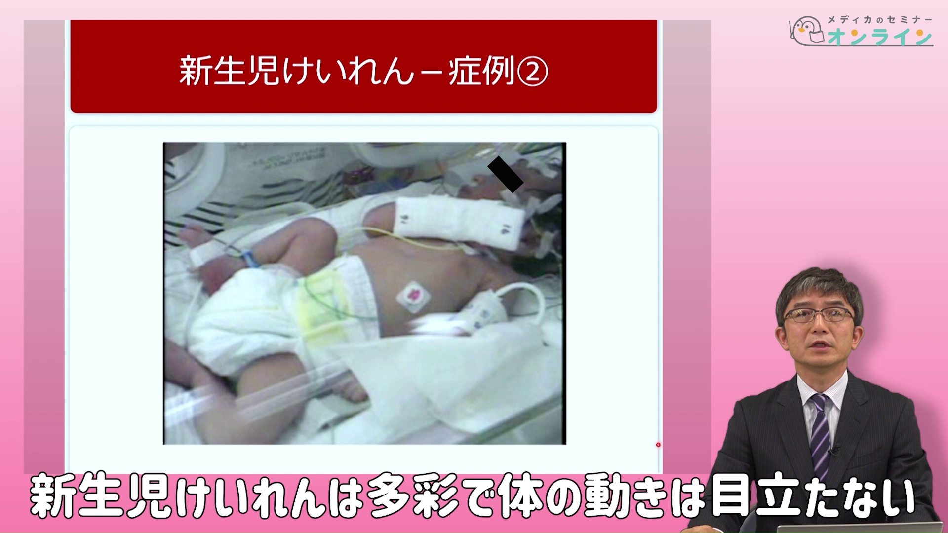 助産師・看護師が知っておきたい正期産児の観察ポイント_症状・疾患編06