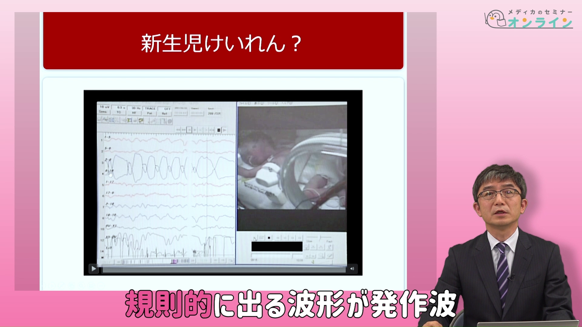 助産師・看護師が知っておきたい正期産児の観察ポイント_症状・疾患編10