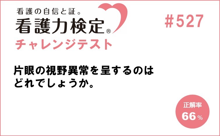 看護力検定チャレンジテスト｜#527