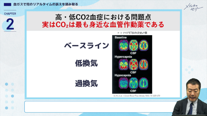 とことんやさしい新生児循環管理12
